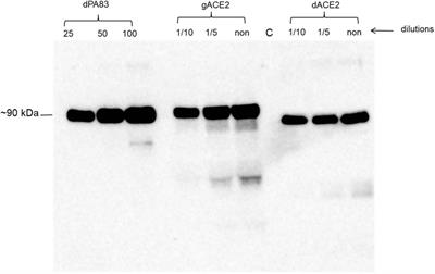 Soluble Human Angiotensin- Converting Enzyme 2 as a Potential Therapeutic Tool for COVID-19 is Produced at High Levels In Nicotiana benthamiana Plant With Potent Anti-SARS-CoV-2 Activity